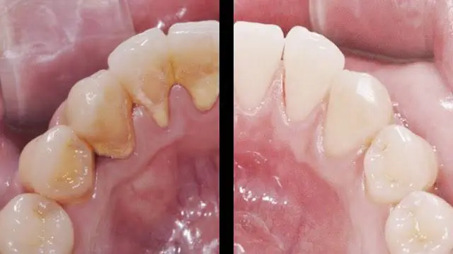 Periodontics